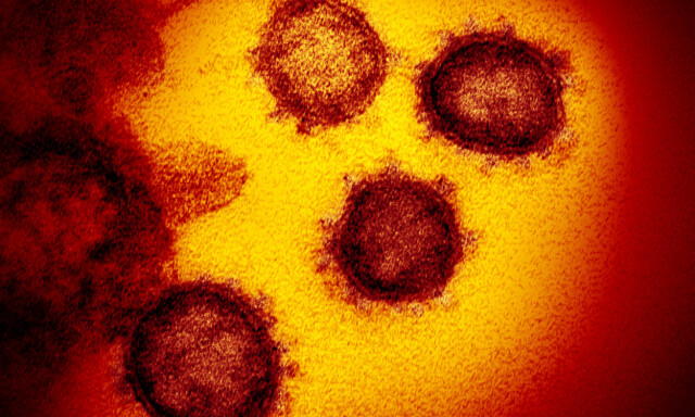 image: 1 av 3 kan være immune fra før